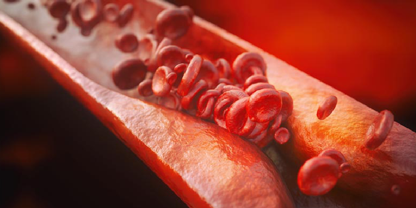 Il colesterolo, quali rischi e come combatterlo
